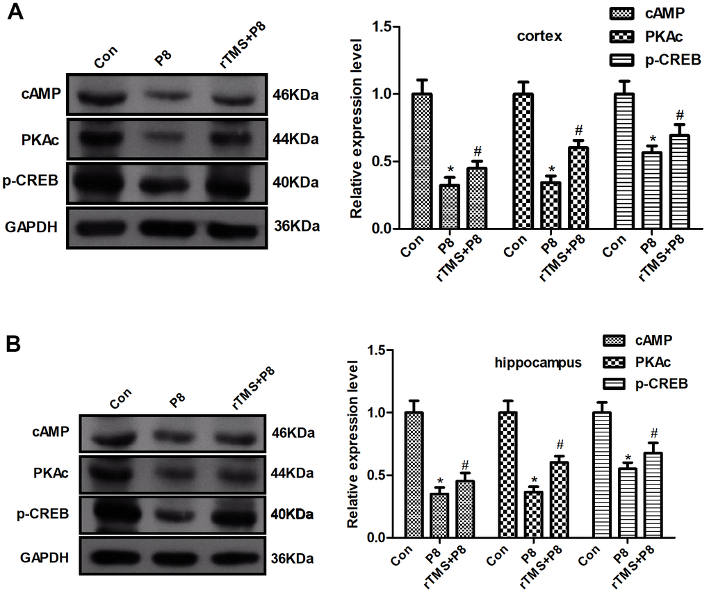 Changes in the cAMP/PKA/CREB pathway in P8 mouse cortex and hippocampus after rTMS treatment. (A) The expression of cAMP, PKAc and p- CREB in the mouse cortex was determined by western blot and quantitative analysis of cAMP, PKAc and p- CREB expression. (B) The expression of cAMP, PKAc and p- CREB in the mouse hippocampus was determined by western blot and the quantitative analysis of cAMP, PKAc and p- CREB expression. The data are presented as the mean ± standard deviation (n =5). *P 