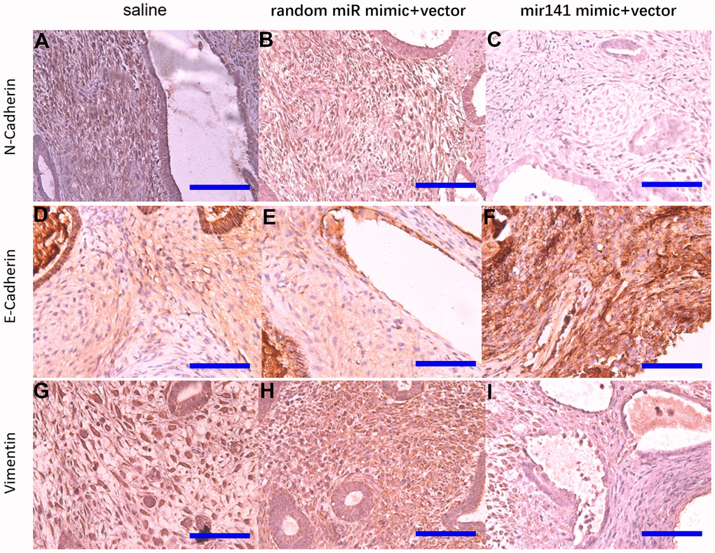 Representative images of N-cadherin, E-cadherin, and Vimentin protein levels detected by immunohistochemistry. N-cadherin protein (A–C), E-cadherin protein (D–F), Vimentin protein (G–I) (bar:50μm).