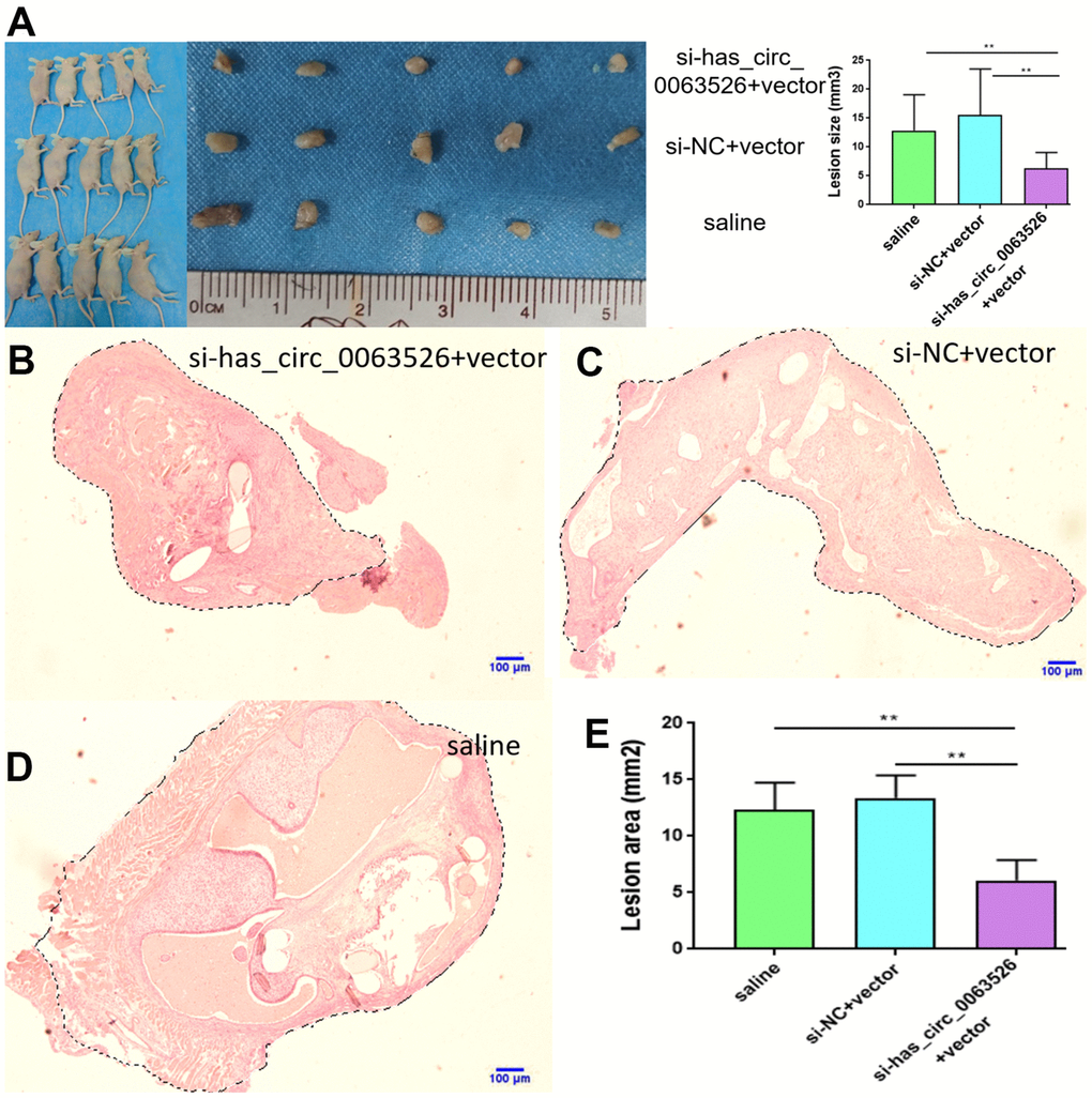 Tissue collection and comparison of each mouse. (A) Comparing the volume of lesions in the left abdomen; (5 mice in each group). (B–E) The difference of histological area of the median section of endometriosis in mice of the si-hsa