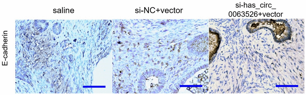Representative images of E-cadherin protein levels detected by immunohistochemistry (bar:50μm).
