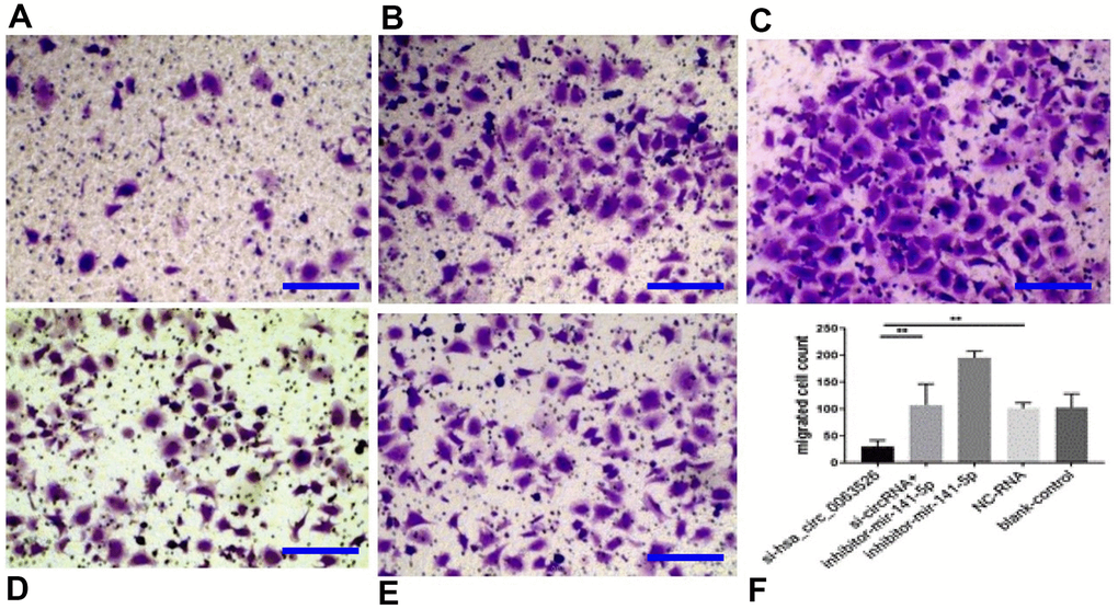 Transwell assay to investigate the effect of inhibition of hsa