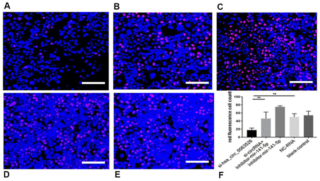 EdU assay was used to investigate the effect of inhibition of hsa