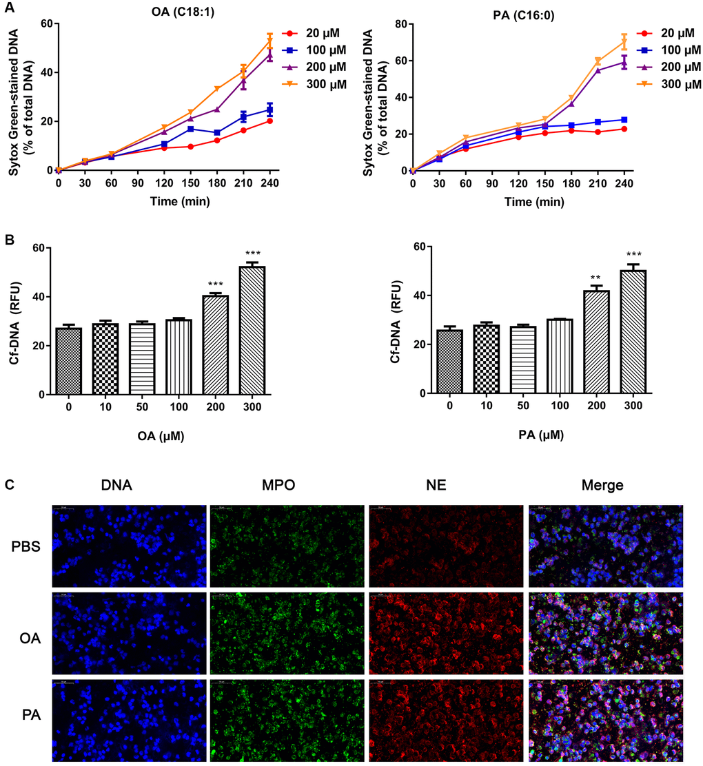 Effects of FFAs on NETs formation. (A) The time curve of NETs formation induced by different concentrations of FFAs. (B) NETs formation rate stimulated by FFAs for 3 h. (C) Confocal images of NETs stimulated by FFAs for 3 h. Abbreviations: FFAs: free fatty acids; NETs: neutrophil extracellular traps. **P ***P 