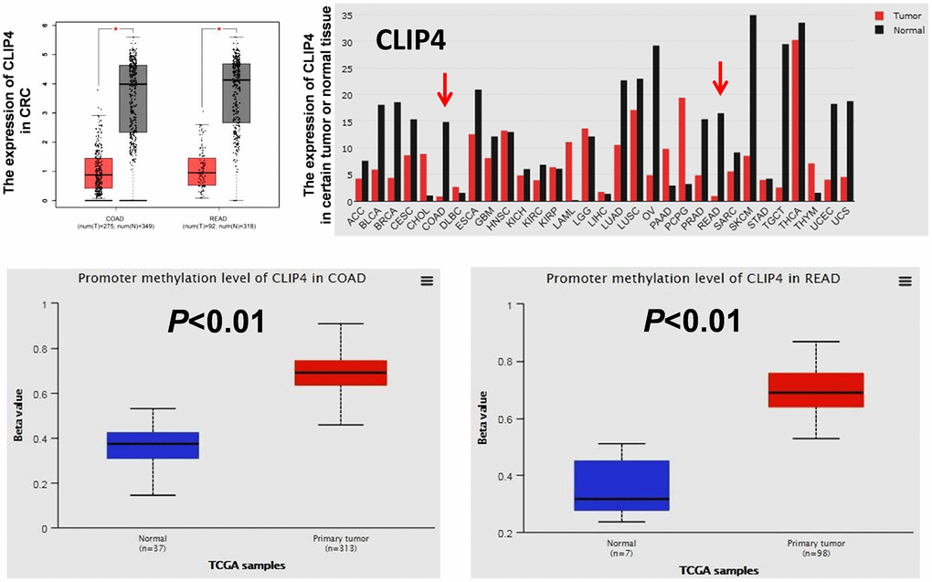 The expression of CLIP4 in tumor tissues and cancer cell lines and the methylation status of CLIP4 in CRC tissues. The mRNA expression of CLIP4 in certain tumor tissues and CRC tissues was analyzed by GEPIA. The methylation level of CLIP4 in CRC and normal tissues was analyzed by UALCAN. Abbreviations: COAD: colon adenocarcinoma; READ: rectum adenocarcinoma.