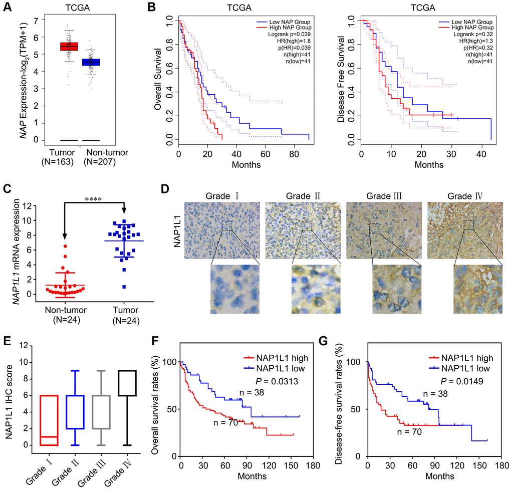 NAP1L1 is highly expressed in glioma and correlates with poor prognosis. (A) NAP1L1 mRNA expression in glioma tissues and para-tumor tissues among the glioma patients obtained from the TCGA database. (B) Kaplan-Meier survival analysis for overall survival based on the NAP1L1 expression data. (C) RT-qPCR analysis of NAP1L1 mRNA expression in 24 glioma tissues and 24 para-tumor tissues. (D, E) Representative images of NAP1L1 staining (D) and IHC score (E) of in (grade I–IV) glioma tissues (scale bar: 50 μm). (F, G) Kaplan-Meier survival analysis for overall survival (F) and Disease Free survival (G) in TMA showing NAP1L1 expression. Data are presented as the mean ± SD for three independent experiments. *P **P ***P 