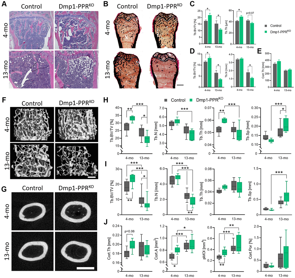 Age-dependent bone loss in Dmp1-PPRKO mice. Vertebrae and long bones of male control and KO animals were analyzed by (A) histology, (B–E) histomorphometry and (F–J) μCT. (A) Representative H&E of the proximal tibiae and (B) Von Kossa staining of the distal femora. Bar = 1.0 mm. Histomorphometric analysis of (C) the L5 and (D) trabecular and (E) cortical region in the distal and midshaft femora, respectively. N = 6–10 per group. Data are presented as mean ± SEM. Representative μCT images of (F) the distal and (G) the midshaft femora. Bars = (F) 300 μm and (G) 1.0 mm. μCT analysis of (H) the L5 and (I) the distal femur (trabecular) and (J) the midshaft femur (cortical) are shown. Data are presented as box and whisker plot. N = 6–16 per group. See Tables 1 and 2 for the full list of parameters. Analyses were performed in a blinded fashion. Unpaired Student’s t test (C–E) and Two-way ANOVA with Tukey’s post hoc test or Mann-Whitney test (H–J) was performed. *p **p ***p 