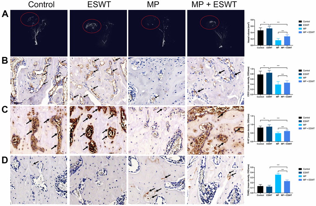 Effect of ESWT on proliferation, angiogenesis, and apoptosis in steroid-induced ONFH in rats. (A) blood supply assessed by micro-CT scanning; (B) CD31 staining in the femoral head; (C) Ki-67 staining in the femoral head; (D) TUNEL staining in the femoral head. (magnification, ×20) n=6 **P ***P 