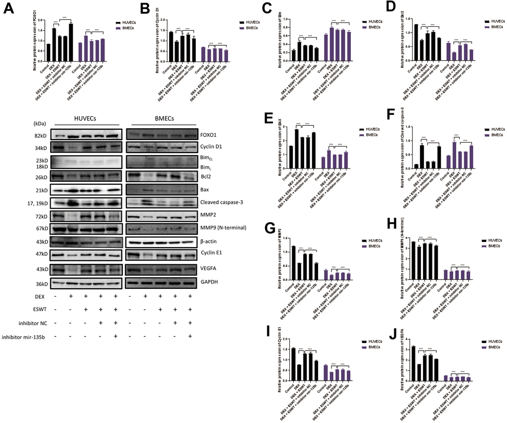 Role of miR-135b in the regulation of FOXO1 and related proteins. After transfection of inhibitor mir-135b, ECs were subjected to ESWT with 0.05 mJ/mm2, 1000 shots followed by DEX with 180 μM. (A–J) Immunoblotting and statistical graph of FOXO1, Cyclin D1, Bim, Bcl2, Bax, cleaved Caspase-3, MMP2, MMP9 (N-terminal), Cyclin E1, and VEGFA. n=3 **P ***P 