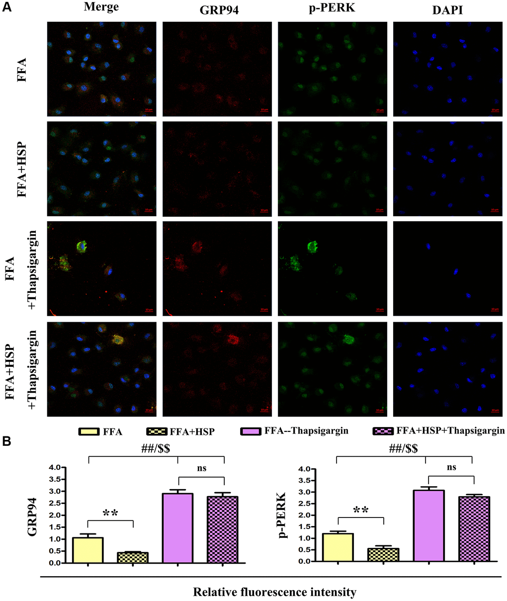 HSP attenuates ERS in human THP-1 cells. As described in the method, FFA-stimulated human THP-1 cells were employed to establish the NAFLD model. Thapsigargin was used to simulate the in vitro ERS model. (A) Immunofluorescence staining was performed to examine the expression of GRP94 and p-PERK with or without HSP. (B) Relative fluorescence intensity of GRP94 and p-PERK. Data were presented as mean ± SEM. **P 