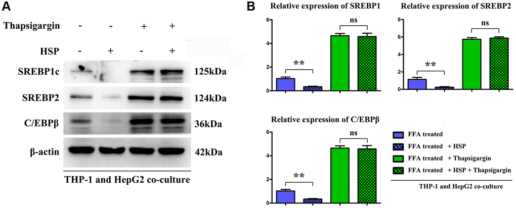 HSP suppressed macrophages modulated the lipid metabolism related proteins expression in hepatocytes cells. FFA-stimulated THP-1 cells treated with HSP or Thapsigargin, and the associated cell supernatant were used to stimulate hepatocytes. The lipid metabolism associated proteins: SREBP-1/-2 and C/EBP β were tested by Western blotting, as shown in (A) and (B). Data were presented as mean ± SEM. **P 