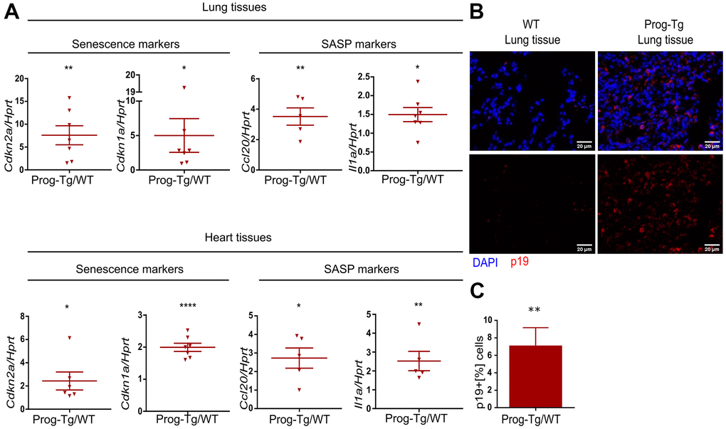 Senescence and SASP are detected in vivo in Prog-Tg mice. (A) qPCR analysis of depicted genes using RNA extracts from lung and heart tissues of Prog-Tg versus WT littermate mice (>25 weeks), n=5-7. (B) Representative immunofluorescence Z-stack projections from lung histological tissues sections of Prog-Tg and WT littermate mice at >25 weeks stained with anti-p19 antibodies and DAPI, Scale bar=20 μm. (C) Quantification of the percentage of p19-positive cells compared to DAPI-positive cells in lung tissues of Prog-Tg vs WT littermates on areas selected in a blinded manner (n=3). For qPCRs, a paired two-tailed Students t test was used and for statistic evaluation of histological staining a Mann-Whitney test. *p