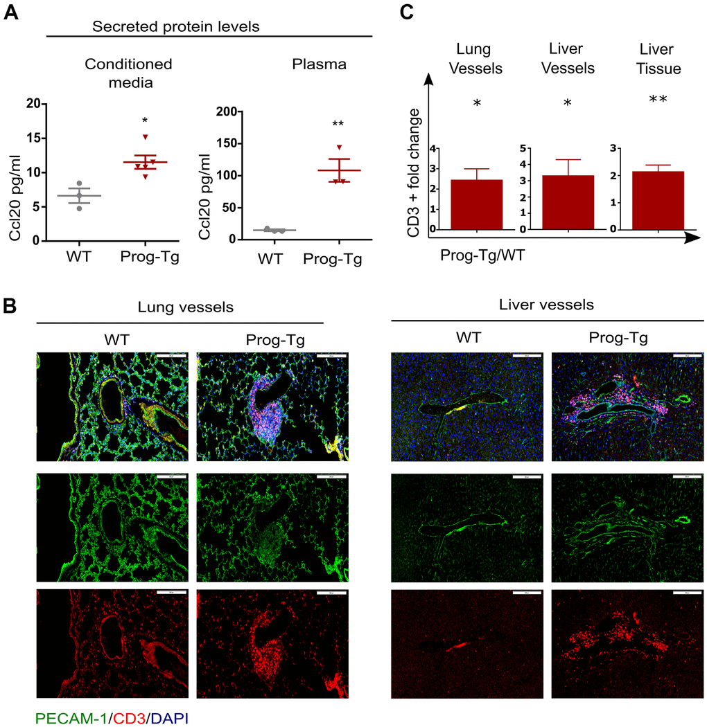 Pro-inflammatory effects in Prog-Tg mice. (A) ELISA was used to detect Ccl20 in cell culture supernatant samples of lung ECs and in plasma of ~30-week-old Prog-Tg and WT mice (n=3-4). (B) Representative immunofluorescence Z-stack projections of lung and liver sections from Prog-Tg and WT littermates (>25 weeks) stained with anti-PECAM and anti-CD3 antibodies and DAPI. (C) Quantification of CD3-positive cells in the vicinity of lung and liver vessels and in liver tissues counted in 10-15 independently selected areas in 4 pairs of Prog-Tg vs WT littermates. Scale bar=200 μm. For ELISA, an unpaired two-tailed Students t test was used. For statistic evaluation of histological stainings, a paired students two-tailed t test. *p