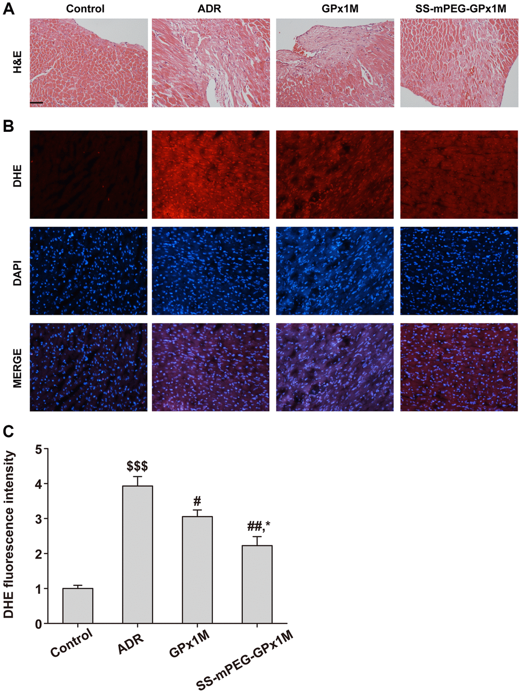 Histopathological changes and ROS measurement in all groups. (A) Analysis of histological evaluation in rat heart tissue using H&E. (B) Determination the accumulation of ROS in rat heart by DHE staining. (C) DHE fluorescence intensity of each group. Scale bars, 100 μm. All data were exhibited as mean ± SD. $$$p #p ##p *p 