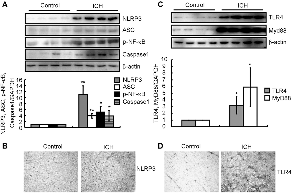 NLRP3 inflammasomes and TLR4 signaling pathways were activated in ICH patients. (A, B) Western blotting and IHC were used to analyze the protein expression of NLRP3, ASC and cleaved caspase-1 as well as the phosphorylation of NF-κB in the brains of ICH patients. GAPDH serves as an internal control. The band densities were measured by Image J to estimate protein levels. (C, D) Western blotting and IHC were used to analyze the protein expression of TLR4 and MyD88 in the brains of ICH patients. GAPDH serves as an internal control. The band densities were measured by Image J to estimate protein levels. The results represent the mean ± SD for the repeated experiments. *P **P 