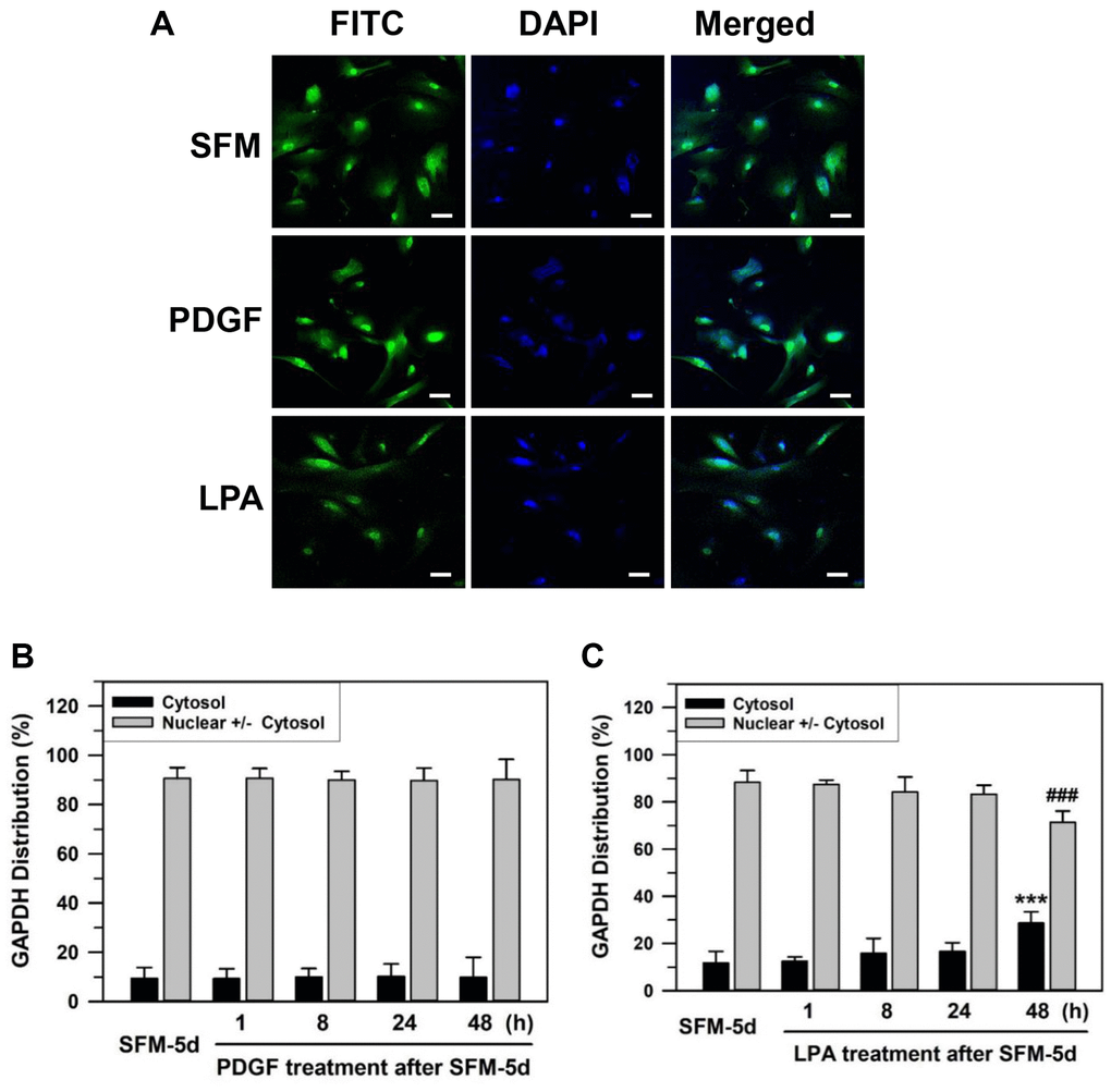 Effect of growth factor re-addition on the nuclear localization of GAPDH after serum depletion of senescent HDFs. (A) Subconfluent senescent HDFs were serum-depleted by incubation in SFM for 5 days. PDGF (100 ng/ml) or LPA (30 μM) was then added to the serum-depleted cells for 2 days. Cells were immunostained against GAPDH and analyzed by confocal laser scanning microscopy. Immunostained cells with re-addition of PDGF or LPA are shown in A (×100 with 50 μm scale bar). (B and C) After the re-addition of PDGF (B) or LPA (C) for the indicated times (1–48 h), the number of cells with cytosolic GAPDH alone (Cytosol) and cells having nuclear GAPDH with or without cytosolic GAPDH (Nuclear +/− Cytosol) was counted, and the percentage distributions were calculated (n = 8 for total replicates) and plotted as means ± standard deviations. ***p ###p 