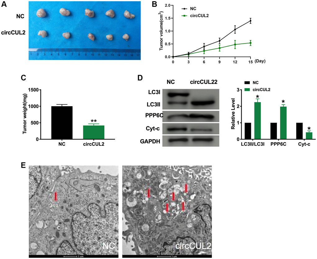 circCUL2 prevents tumor growth in vivo. (A) Tumors were removed from the mice 15 days after circCUL2, and NC-SW480 cells were treated, respectively n = 5. (B–C) Tumor volume and weight were shown after the tumors were collected. n = 5, *P **P D) The protein level of LC3, PPP6C, Cyt-c in tumor tissues. n = 5, *P E) Transmission electron microscopy (TEM) analysis showing autophagosome (arrowed) after treated with circCUL2. The autophagosome is shown by the red arrow.