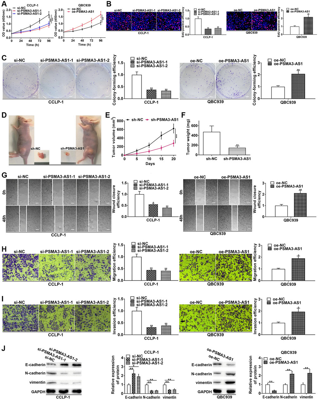 PSMA3-AS1 promotes CCA cell proliferation, invasion and EMT. (A) CCK-8 and (B) EdU assays determined the effect of PSMA3-AS1 on CCA proliferation. (C) Colony formation assay determined the effect of PSMA3-AS1 on colony-forming ability of CCA cells. (D) The effect of PSMA3-AS1 on CCA proliferation in vivo. (E) Knocking down PSMA3-AS1 restrained the tumor volume and (F) tumor weight in nude mice. (G) Wound healing and (H, I) transwell assays validated the effects of PSMA3-AS1 on migration and invasion of CCA cells. (J) The effect of PSMA3-AS1 on EMT process of CCA cells. *P **P ***P 