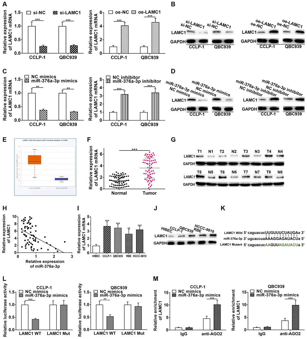 LAMC1 is directly restrained by miR-376a-3p. (A) Knockdown efficiency and amplification efficiency of LAMC1 in CCA cells both at mRNA and (B) protein level. (C) miR-376a-3p regulated LAMC1 expression both at mRNA and (D) protein level. (E) LAMC1 expression in TCGA database. (F) The expression of LAMC1 in CCA tissues both at mRNA and (G) protein level. (H) LAMC1 expression was negatively correlated with miR-376a-3p expression. (I) The expression of LAMC1 in CCA cells both at mRNA and (J) protein level. (K) The wild type and mutant type of LAMC1 3’UTR were cloned into luciferase reporter plasmids, respectively. (L) The miR-376a-3p mimics reduced the luciferase activity of LAMC1 wild type rather than mutant type. (M) RIP assay uncovered that LAMC1 was enriched by anti-AGO2 antibodies with miR-376a-3p mimics in CCA cells. **P ***P 