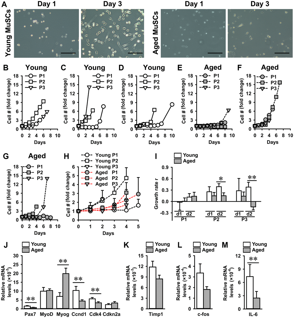 Aged MuSCs exhibited a reduced growth rate compared to young MuSCs. (A) Micrographs of young and aged MuSCs at day 1 and 3 of culture. (B–G) Fold-change in cell number of young and aged MuSCs in vitro at three passages (P1-P3). Each graph shows young and aged MuSCs, n = 1 (from 1 young or aged mouse). (H) Fold-change in cell number of young and aged MuSCs at three passages (P1-P3; pooled data), over the initial cell number seeded, as a function of time (days). n = 3 (from 3 young or aged mice). (I) Growth rate r of young and aged MuSCs at three passages (P1-P3) over two days illustrating an increased growth rate of young MuSCs at P2 and P3. n = 3 (from 3 young or aged mice). (J–M) Gene expression of Pax7, MyoD, Myog, Ccnd1, Cdk4, Cdkn2a, Timp1, c-fos, and IL-6. Young MuSCs, n = 11 (from 4 young mice). Aged MuSCs, n = 9 (from 3 aged mice). Abbreviation: MuSCs: muscle stem cells. Values are mean ± SEM. Significant effect of age, *p **p 