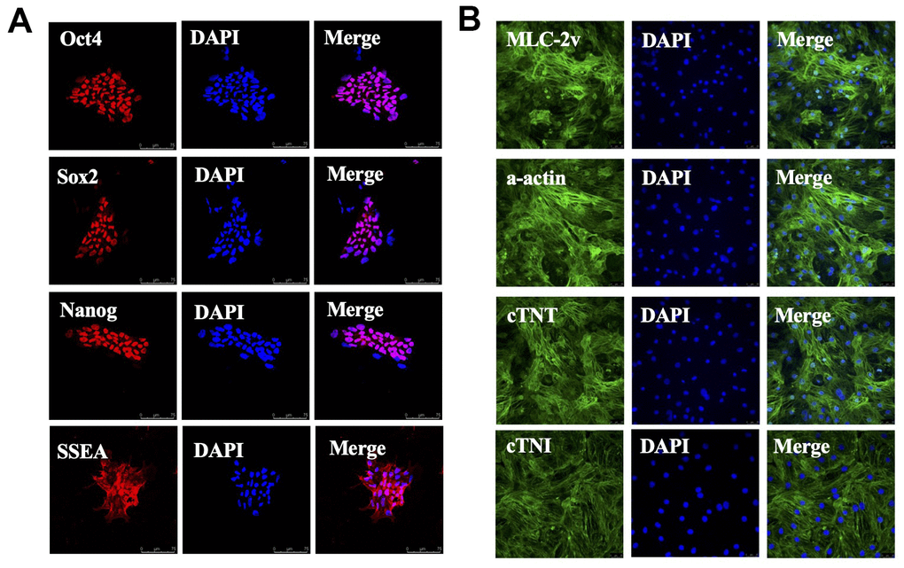 Stem cells are induced to differentiate into cardiomyocytes. (A) Human embryonic stem cells (hESC) expressing Oct4, Sox2, Nanog and SSEA. (B) hESC-derived cardiomyocytes (hESC-CMs) expressing MLC-2v, α-actinin, cardiac troponin-I (cTnI) and cardiac troponin-T (cTnT). Scale bars=25μm.