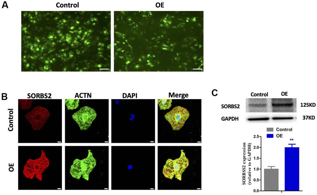 Expression of SORBS2 in hESC-CMs transfected with HBLV-h-SORBS2 was higher compared with the control groups. (A) Cardiomyocytes transfected with lentivirus. (B) Representative images of SORBS2 in hESC-CMs transfected with empty virus (control) and HBLV-h-SORBS2 (SORBS2-OE). (C) Western blotting detection of the expression levels of SORBS2 in overexpression group and control group. The protein level of SORBS2 was normalized to GAPDH for each sample. Statistical analysis of the expression of SORBS2 in hESC-CMs transfected with empty virus (control) and HBLV-h-SORBS2 (SORBS2-OE) (n =3 per group, * p 