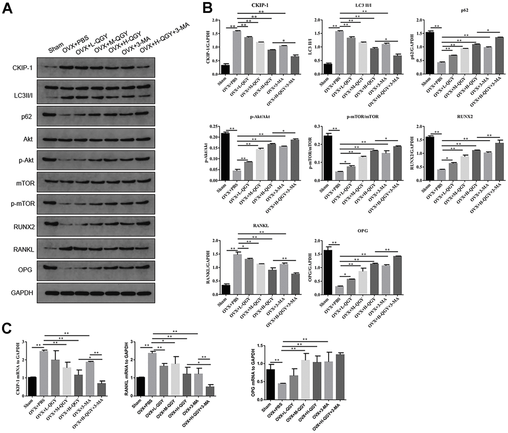 The effect of QGY on the protein expression of femoral tissue in osteoporotic rats. (A, B) Representative figures (A) and quantitative analysis (B) of protein expression of CKIP-1, LC3II/I, p62, p-AKT/AKT, p-mTOR/mTOR, RUNX2, RANKL and OPG. (C) Gene expression levels of CKIP-1, RANKL and OPG. The data are presented as the means ± SD (n=5). *p**p