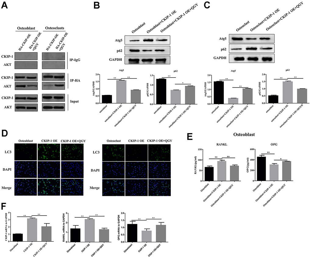 QGY mediates the effect of CKIP-1 on autophagy through the AKT/mTOR pathway. (A) Co-IP assay in the osteoblasts and osteoclasts. (B, C) Representative figures and quantitative analysis of protein expression of Atg5 and p62 in the osteoblasts (B) and osteoclasts (C). (D) LC3 immunofluorescence assay in the osteoblasts and osteoclasts. (E) RANKL and OPG content analysis in the osteoblasts. (F) Gene expression levels of CKIP-1, RANKL and OPG in the osteoblasts. The data are presented as the means ± SD (B, C, E, F: n=6; D: n=3). *p**p