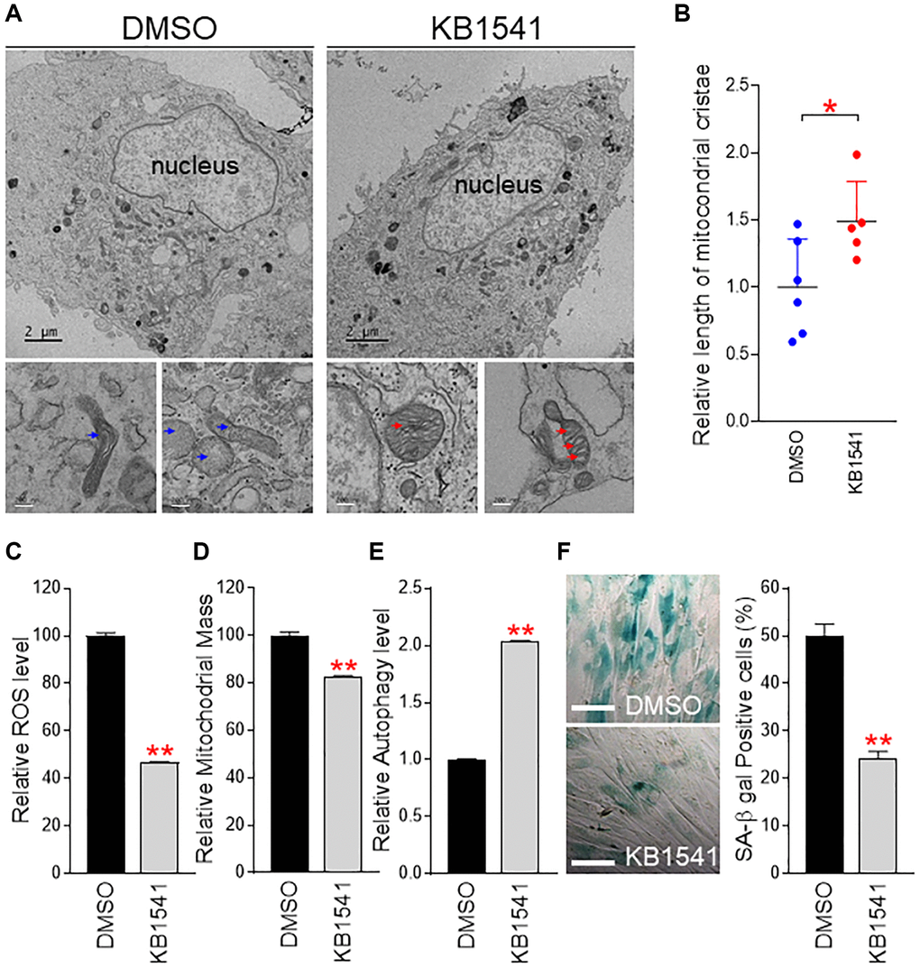 KB1541 ameliorates senescence phenotypes. (A) Electron microscopy analysis revealed that DMSO-treated senescent fibroblasts exhibited less cristae wrinkle folds (blue arrow), whereas KB1541 treatment in senescent fibroblasts showed increased the number of cristae wrinkle folds (red arrow). Upper image: Scale bar 2 μm. Lower image: Scale bar 200 nm. (B) Comparison of cristae length between DMSO and KB1541-treated senescent fibroblasts. *P t-test. Mean ± S.D., n = 6. (C and D) Flow cytometric analysis of ROS and mitochondrial mass using MitoSOX and MitoTracker green, respectively. **P t-test. Mean ± S.D., n = 3. Flow cytometry data of ROS and mitochondrial mass were presented in Supplementary Figure 4A. (E) Flow cytometric analysis of autophagy level using Cyto–ID assay. **P t-test. Mean ± S.D., n = 3. Flow cytometric data of autophagy level were presented in Supplementary Figure 4B. (F) Quantification of SA-β gal positive cells. **P t-test. Means ± S.D., n = 4. Scale bar 100 μm.