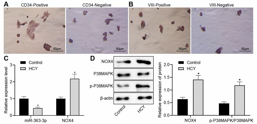 Reduced miR-363-3p expression and abundant NOX4 and p38 MAPK expressions in HCY-induced CAECs. (A) positive and negative staining for goat antibody to CD34 (scale bar = 25 μm); (B) positive and negative staining for rabbit antibody to Factor VIII (scale bar = 25 μm); (C) miR-363-3p expression and NOX4 mRNA expression were determined by RT-qPCR in HCY-induced CAECs; (D) Representative Western blots of NOX4, p38 MAPK and p-p38 MAPK proteins and their quantitation in HCY-induced CAECs, normalized by β-actin. The data were analyzed by paired t-test. n = 3. * p 