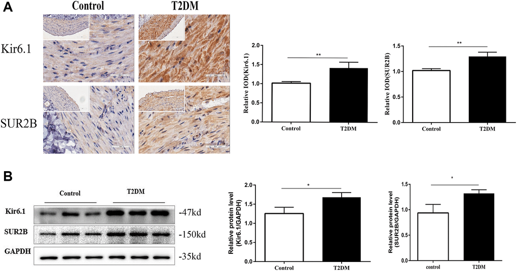 The expression of KATP channels were altered in T2DM rats. (A) Immunohistochemical staining of Kir6.1 and SUR2B subunits of KATP channels in the colon muscle layers in the two groups of rats at 18 w. Left panel: Representative image; right panel: Quantitative analysis. Low magnification, 200×, scale bar = 100 μm; high magnification, 400×, scale bar = 50 μm. (B) Western blotting analysis of Kir6.1 and SUR2B subunits of KATP channels in the colon muscle layers in the two groups of rats at 18 w. Relative expression was normalized to that of GAPDH. Left panel: Representative image; right panel: Quantitative analysis. *P **P n = 10, T2DM group n = 8.