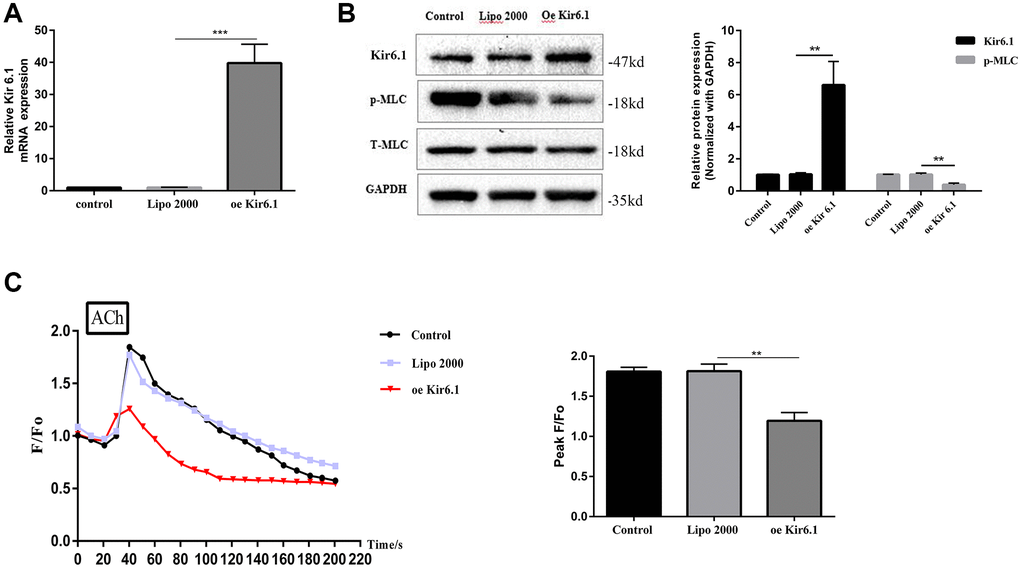 Overexpression of the Kir6.1 subunit decreases intracellular Ca2+ concentration ([Ca2+]i) and MLC phosphorylation. (A) qRT-PCR analysis of Kir6.1 subunit mRNA levels in CSMCs transfected with blank or Kir6.1 expression plasmids. Relative expression was normalized to that of GAPDH. (B) Western blotting analysis of Kir6.1 subunit protein levels and phosphorylation of MLC in CSMCs transfected with blank or Kir6.1 expression plasmids. Relative expression was normalized to that of GAPDH. Left panel: Representative image; right panel: Quantitative analysis from three independent experiments. (C) Changes in fluorescence intensity caused by [Ca2+]i relative to baseline (F/F0) in CSMCs transfected with blank or Kir6.1 expression plasmids. F0 was derived from the averaged intensity of the first 0–30 s. CMSCs were incubated in calcium-free HBSS base buffer. Left panel: Fluorescence intensity of [Ca2+]i; right panel: Quantitative analysis of peak F/F0 and a representative image of fluorescence at peak F/F0 from three independent experiments. **P ***P 