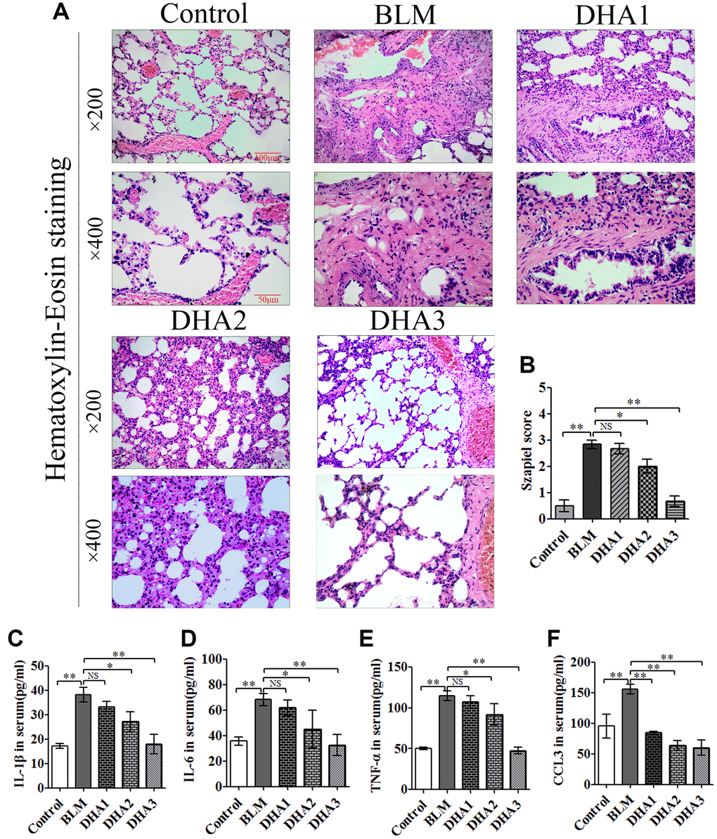 DHA reduces bleomycin-induced pulmonary fibrosis in rats. Rats were sacrificed at 28 days after the injection of bleomycin, with or without DHA treatment. Their blood and lungs were removed. (A) H&E staining of bleomycin-treated rat lungs, with and without DHA treatment. (B) Lung inflammation was scored (n = 6). (C) IL-1β, (D) IL-6, (E) TNFα, and (F) CCL3 protein in serum were determined using ELISA (n = 6). Data are expressed as the means ± standard error. *P **P 