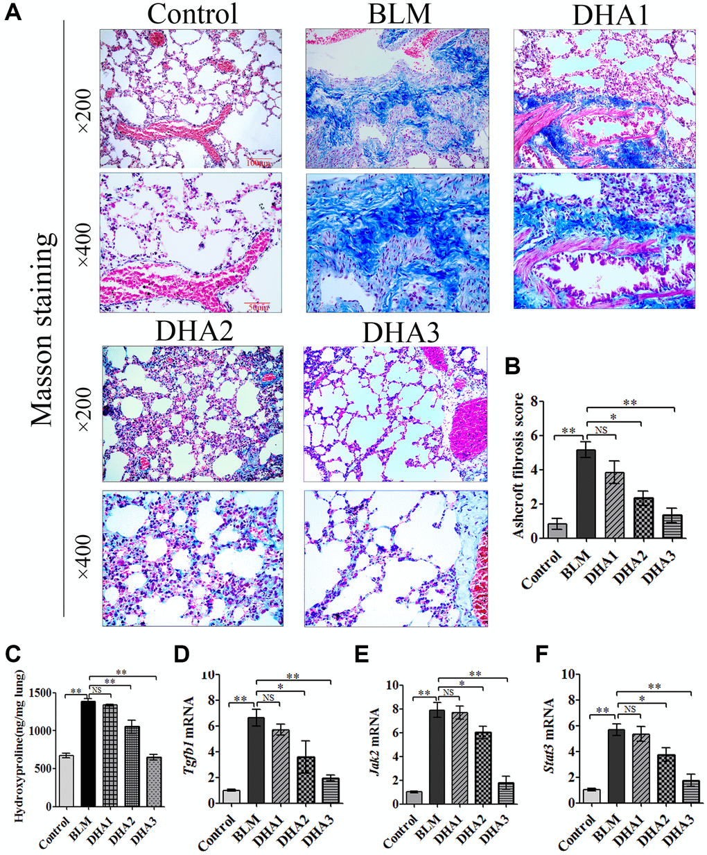 DHA reduced collagen deposition in pulmonary fibrosis tissues and inhibited the expression of Tgfb1, Jak2, and Stat3 mRNA in lung tissues. The rats were sacrificed at 28 days after bleomycin injection, with or without DHA treatment, their lungs were removed and blood collected. (A) Representative images of Masson staining of bleomycin-treated rat lungs, with and without DHA treatment. (B) Evaluation of pulmonary fibrosis using the Ashcroft score (n = 6). (C) Determination of hydroxyproline in lung tissue (n = 6). (D) Tgfb1, (E) Jak2, and (F) Stat3 mRNA levels in lung tissues were determined using qRT-PCR (n = 6), data are expressed as fold change in mRNA expression normalized to Gapdh expression, with respect to the control group. *P **P 