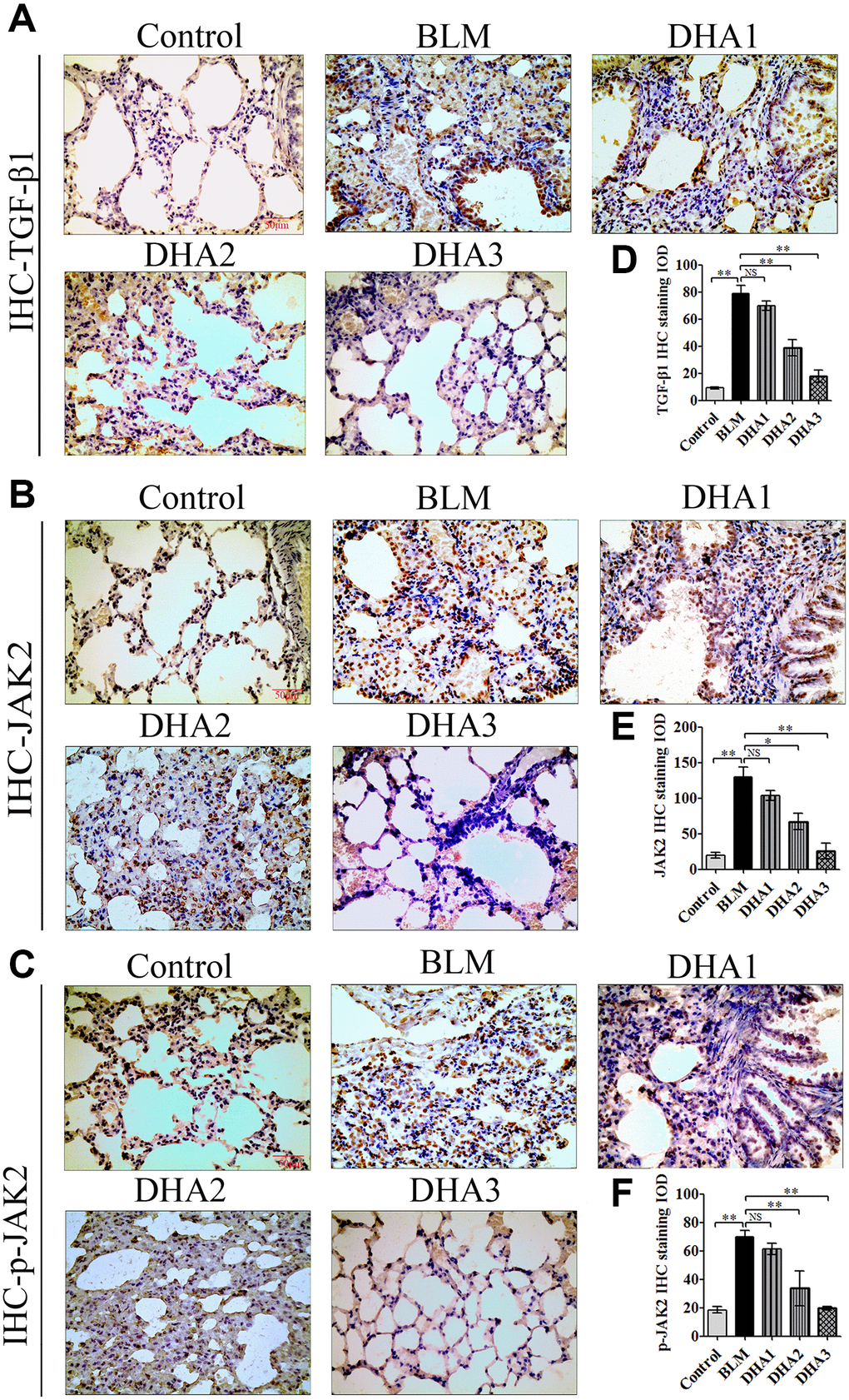 DHA inhibited pulmonary fibrosis via the JAK2/STAT3 pathway (A) Representative images of (A) TGF-β1, (B) JAK2, and (C) p-JAK2 proteins in lung tissues, detected using IHC. Mean IOD of (D) TGF-β1, (E) JAK2, and (F) p-JAK2 IHC staining. Data are expressed as the means ± standard error. *P **P 