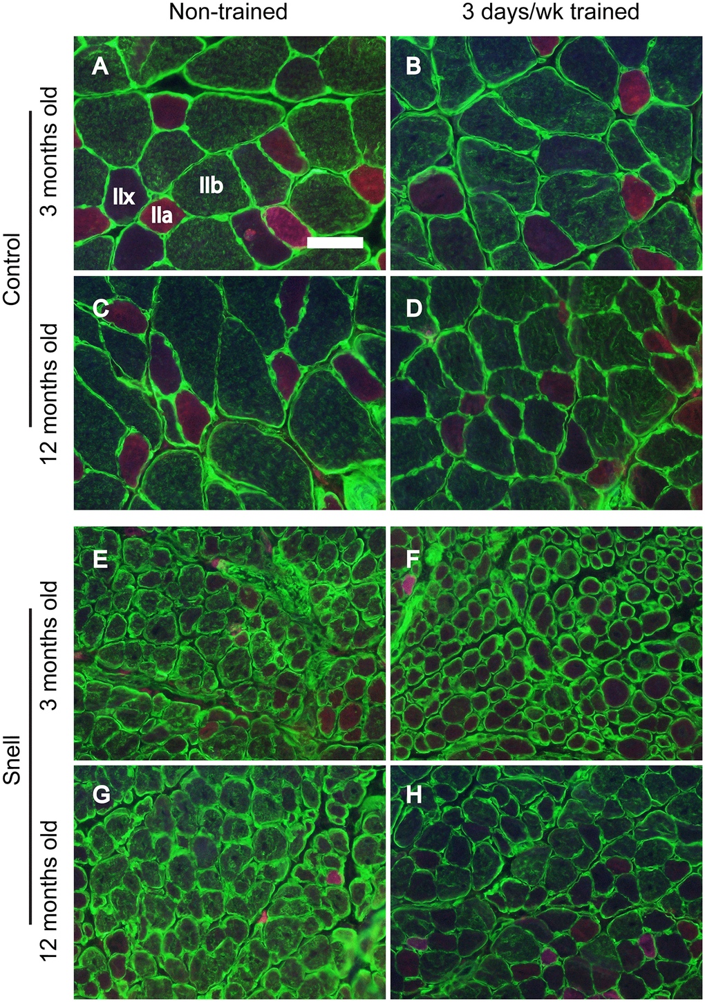 Fiber type immunofluorescence staining for muscles of control (A–D) and Snell dwarf (E–H) mice following 3 days per week training. Staining for laminin (green) and multiple MHC isoforms – IIb (green), IIa (red), and IIx (negative for staining) – are apparent in the images with shifting away from IIb to IIx with training unique to Snell dwarf mice. Scale bar = 50 μm.