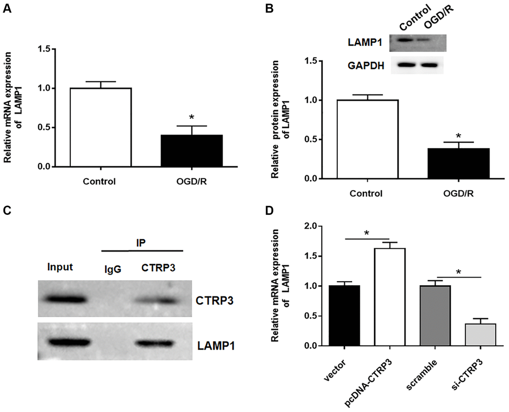 CTRP3 directly interacted with LAMP1. (A, B) Relative mRNA and protein expression of CTRP3 was determined by using RT-qPCR and Western blotting. (C) The relationship between CTRP3 and LAMP1 was detected by using Co-IP. (D) The effects of CTRP3 silence or overexpression on the mRNA level of LAMP1 was measured by using RT-qPCR.