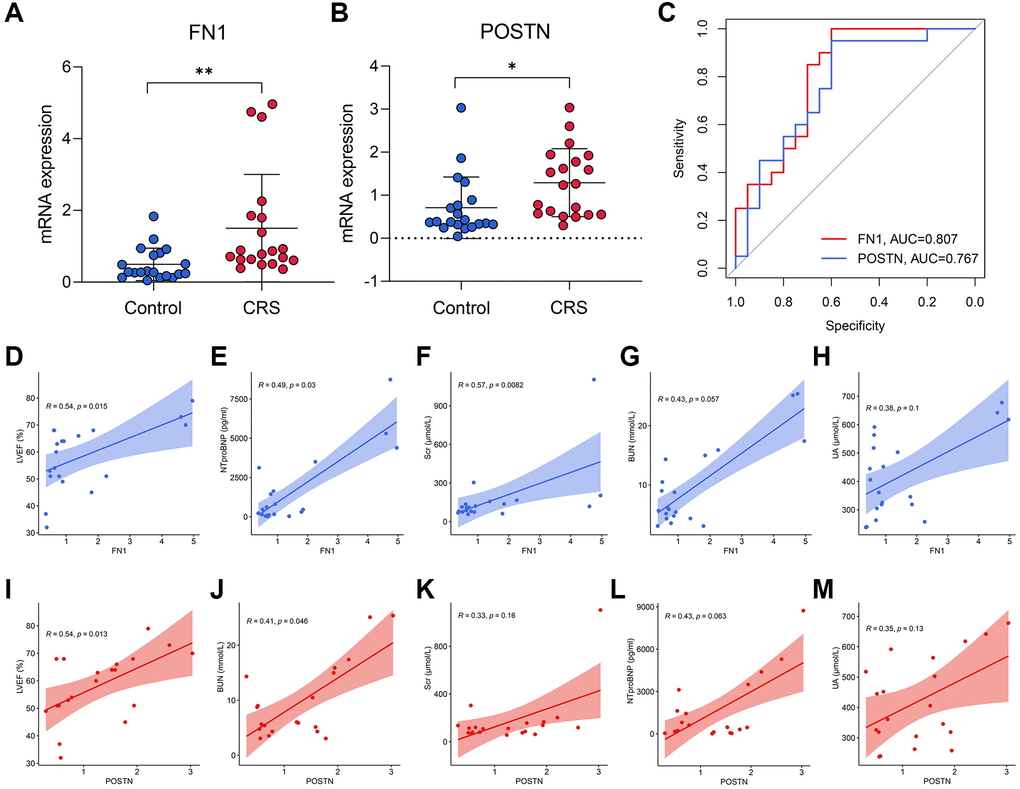 The diagnostic ability of FN1 and POSTN to CRS. (A, B) FN1 (A) and POSTN (B) were up-regulated in the peripheral blood sample of CRS patients from the Shunde Hospital of Southern Medical University. (C) The ROC analysis showed that FN1 and POSTN could discriminate the CRS samples with high efficacy. (D–H) The association of FN1 expression with LVEF (D), NTproBNP (E), Scr (F), BUN (G), and UA (H). (I–M) The association of POSTN expression with LVEF (I), BUN (J), Scr (K), NTproBNP (L), and UA (M). Abbreviations: CRS: cardiorenal syndrome; ROC: receiver operating curve; LVEF: left ventricular ejection fraction; NTproBNP: N-terminal-pro-B-type natriuretic peptide; Scr: serum creatinine; BUN: blood urea nitrogen; UA: uric acid. *P **P ***P 