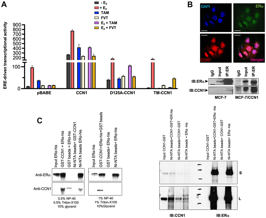 CCN1 directly binds the estrogen receptor and regulates its transcriptional activity. (A) MCF-7/pBABE, MCF-7/CCN1, MCF-7/D125A-CCN1, and MCF-7/TM-CCN1 cells were transiently with an ERE-Luciferase reporter (the ERE-containing reporter plasmid) and pRL/CMV (an internal reporter plasmid to control for transfection efficiency). Cells were incubated in the absence or presence of estradiol (E2, 10−9 M), tamoxifen (10−7 M), fulvestrant (10−7 M), their combinations, or vehicles for 24 h, and cell extracts were analyzed for Luciferase activity. Data shown represent mean (columns) ± S.D. (bars) (n=3). (B) Top: Microphotographs show representative in situ immunofluorescence staining of CCN1 and/or estrogen receptor (ERα) in MCF-7/CCN1 cells. Scale bar is 10 μm. Bottom: ERα in the cell lysates of MCF-7 and MCF-7/CCN1 cells was immunoprecipitated and immunoblotted with anti-ERα and anti-CCN1 antibodies. (C) Representative immunoprecipitation results of His-tagged ERα and GST-CCN1 using immobilized Ni2+. Purified GST-CCN1 protein was incubated with human recombinant ERα-His protein and Ni-NTA His•Bind resin beads. As controls, ERα-His protein was incubated with GST-only beads or GST-CCN1 was incubated with Ni-NTA beads alone. Proteins retained in the beads were denatured and blotted with the indicated antibodies. Results in (B, C) are representative of three independent experiments. (S: Short exposure; L: Long exposure).