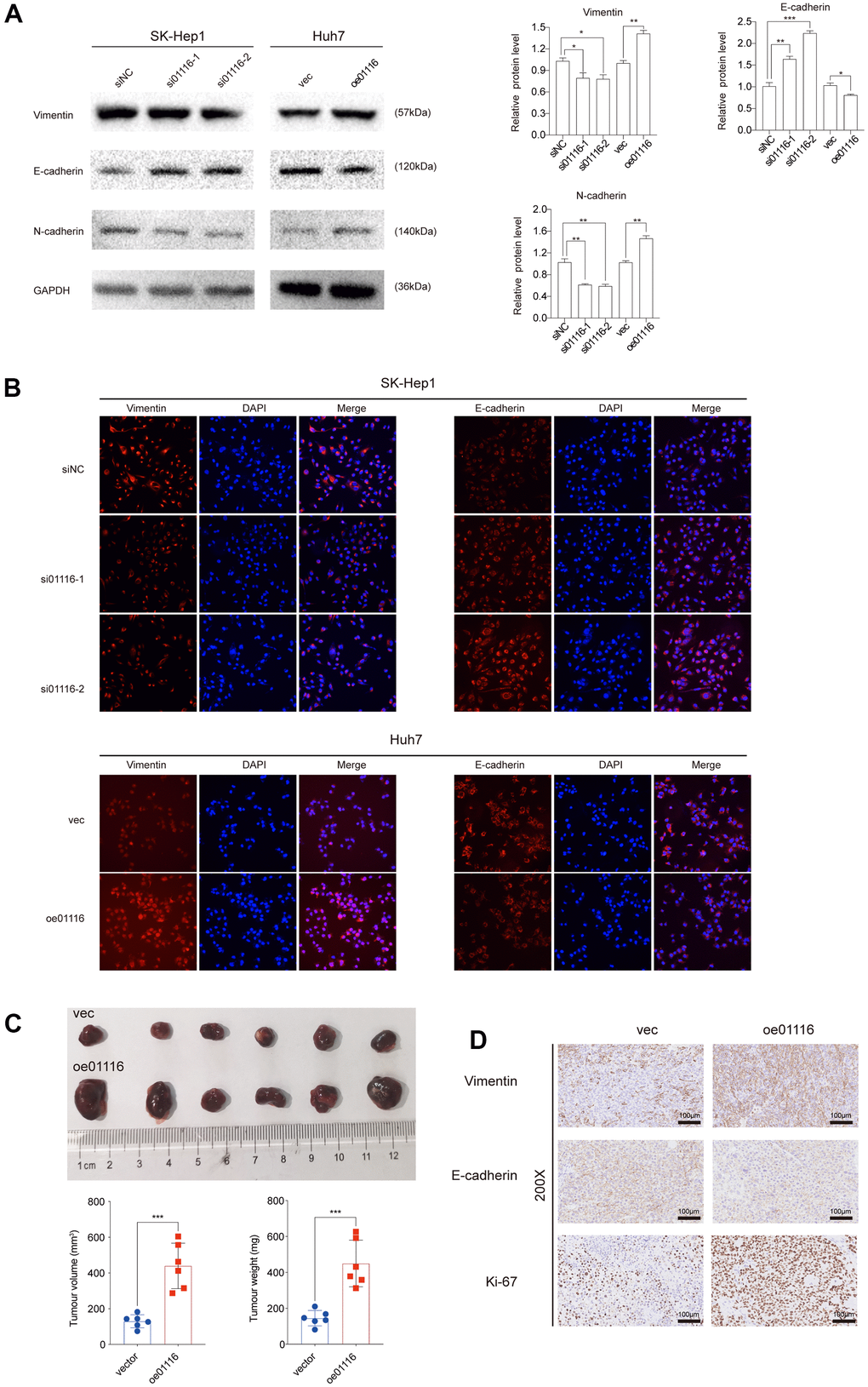 (A) EMT markers were examined via western blot analysis. (B) Immunofluorescence assay was used to detect EMT markers. (C) Image of subcutaneous tumor tissues. The volume and weight of tumors were measured. (D) Ki67, vimentin and E-cadherin were observed in subcutaneous tumor tissues by IHC. **P 