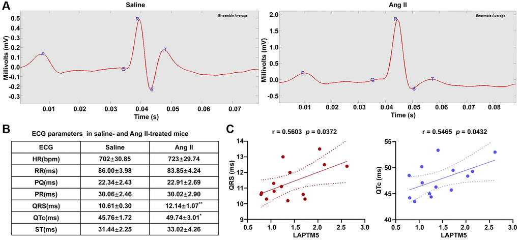 ECG evaluation in Ang II infusion–induced HT with the LVH mouse model. (A) Representative ECG recordings from saline- and Ang II-treated mice for 7 days. (B) Table shows the different of ECG parameters in saline- and Ang II-treated mice for 7 days (*p **p***p C) Analysis of Pearson’s correlation between LAPTM5 and the widths of the QRS complex and the QTc interval.
