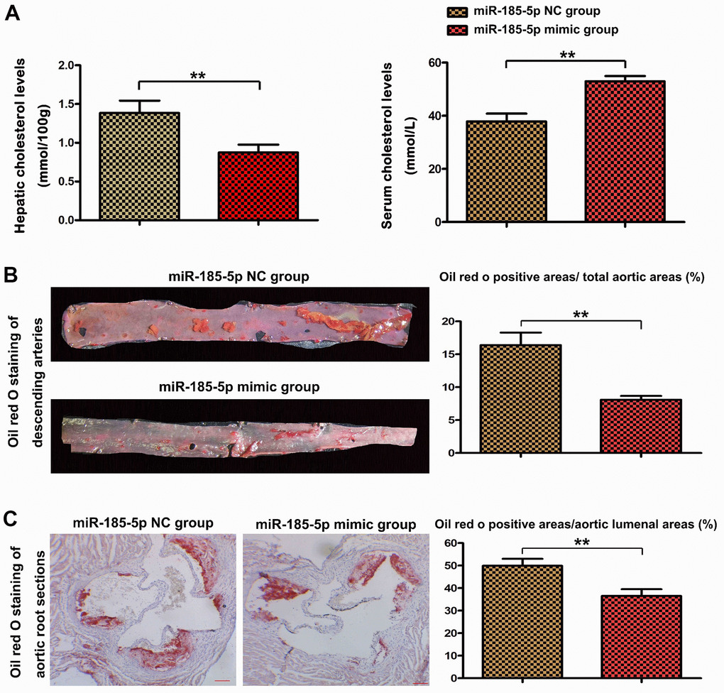 MiR-185-5p mimic decreased atherosclerotic lesions in HFD-fed apoE−/− mice. To induce atherosclerosis, apoE−/− mice fed a high-fat diet were administered with miR-185-5p mimic via tail vein once every 2 weeks for 12 weeks. (A) hepatic cholesterol levels and serum cholesterol levels, (B) The descending arteries were obtained from the apoE−/− mice and stained with Oil-red-O to examine the plaque formation. (C) The longitudinal section of the mice's aortic root was stained with Oil red O to examine the lesion area.