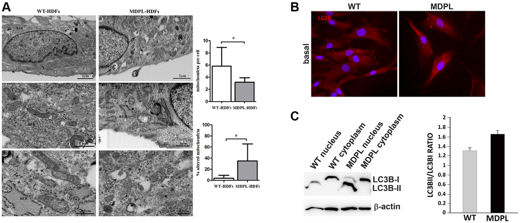 Ultrastructural analyses of mitochondria and their autophagic activity. (A) FIB/SEM analysis of MDPL-HDFs vs. WT fibroblasts. Healthy cells (on the left) show regular nucleus (N), several mitochondria (m) and abundant rough endoplasmic reticulum (RER). By contrast, MDPL-HDFs cells (on the right) display fewer RER cisternae, while smooth endoplasmic reticulum (SER) and Golgi apparatus are more prominent than in WT. Diseased cells also show several autophagosomes (black arrows), often containing partially digested mitochondria. Statistical analysis demonstrates significant decreased number of mitochondria, which are also significantly more damaged, than their normal counterpart (*p B) Representative image of immunofluorescence analysis of LC3 in WT and MDPL HDFs. (C) Western blot densitometric analysis of the LC3-II/I ratio. Data are presented as means ± SD. β-actin was used as control.