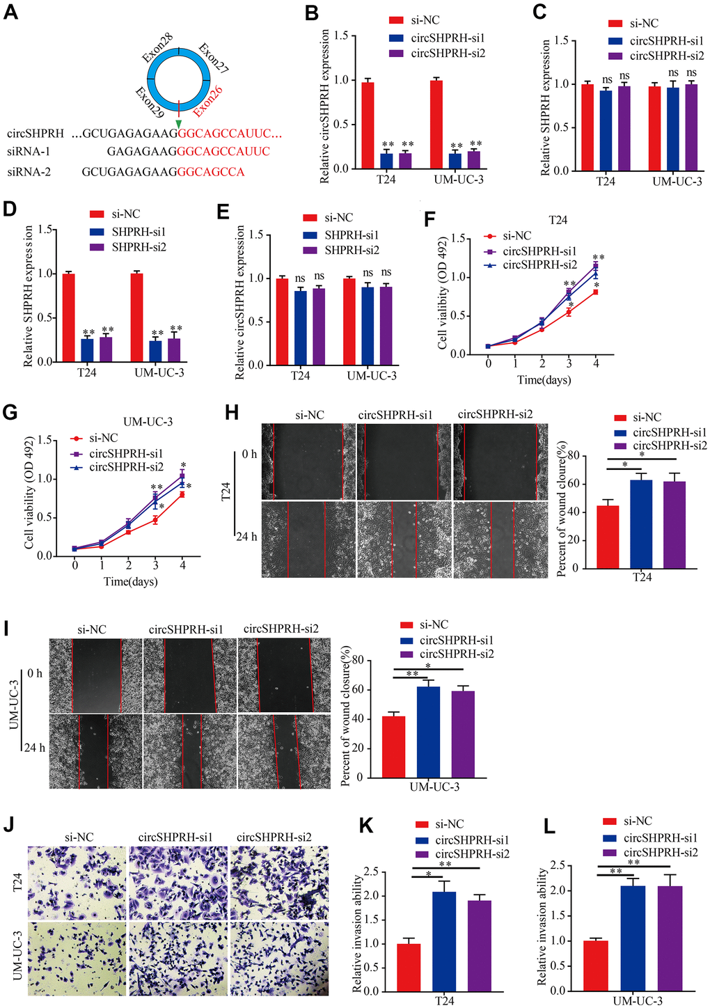 circSHPRH knockdown promotes BCa cell proliferation, migration and invasion. (A) si-circSHPRH was specifically designed to target the back-splice site of circSHPRH. (B, C) The relative expression of circSHPRH and SHPRH in T24 and UM-UC-3 cells transfected with si-NC or si-circSHPRH. (D, E) The relative expression of SHPRH and circSHPRH in T24 and UM-UC-3 cells transfected with si-NC or si-SHPRH. (F, G) circSHPRH knockdown enhanced cell viability in T24 and UM-UC-3 cells, as shown by the MTS assay. (H, I) circSHPRH knockdown promoted the migration ability of T24 and UM-UC-3 cells, as measured by wound healing assay. (J–L) circSHPRH knockdown promoted the invasion ability of T24 and UM-UC-3 cells, as detected by Transwell invasion assay. Magnification, 200×, *PP