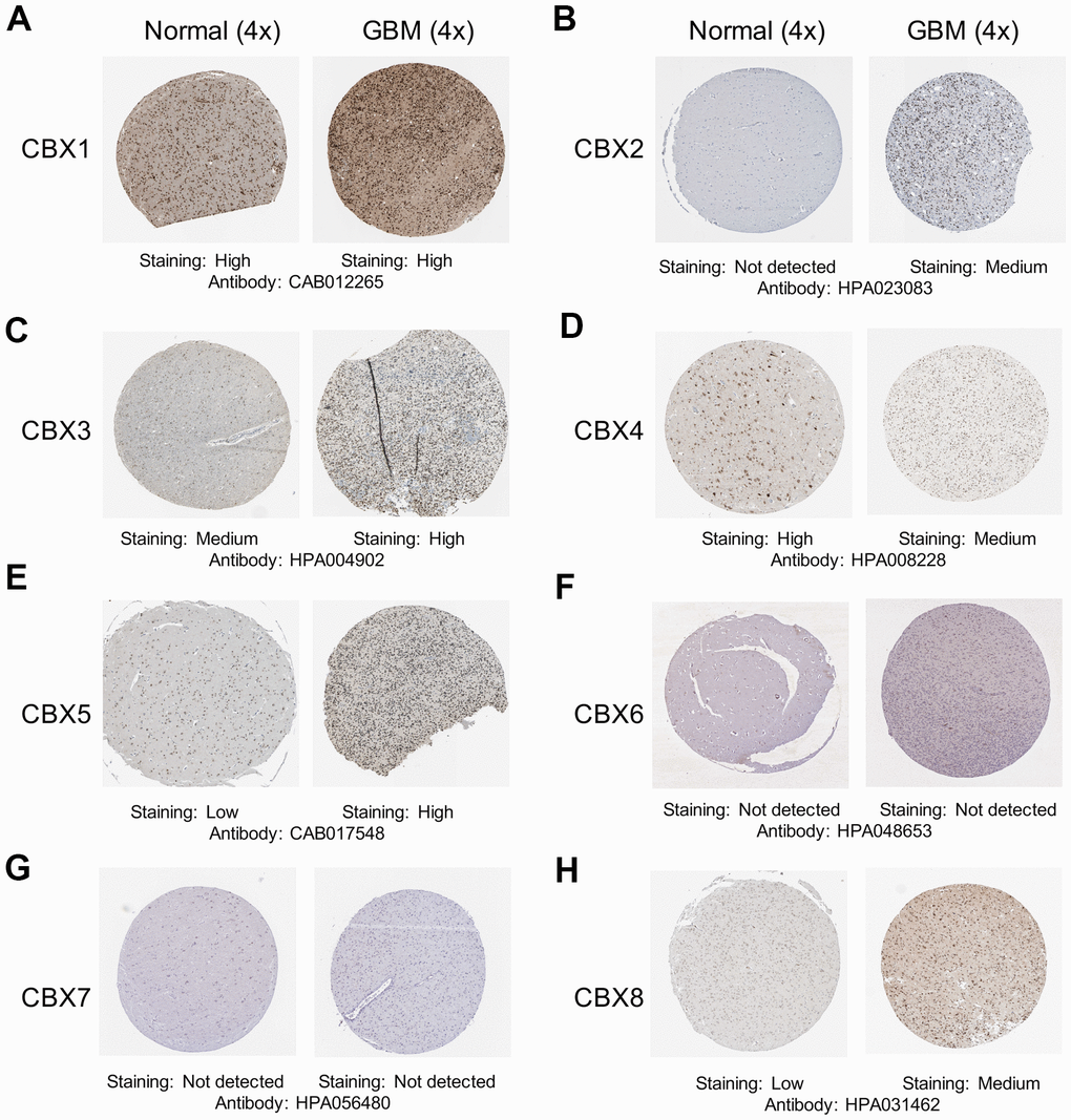 Representative immunohistochemistry images of CBXs from The Human Protein Atlas. (A–H) The protein expression profiles of eight CBXs in GBM tissues and normal glial tissues.