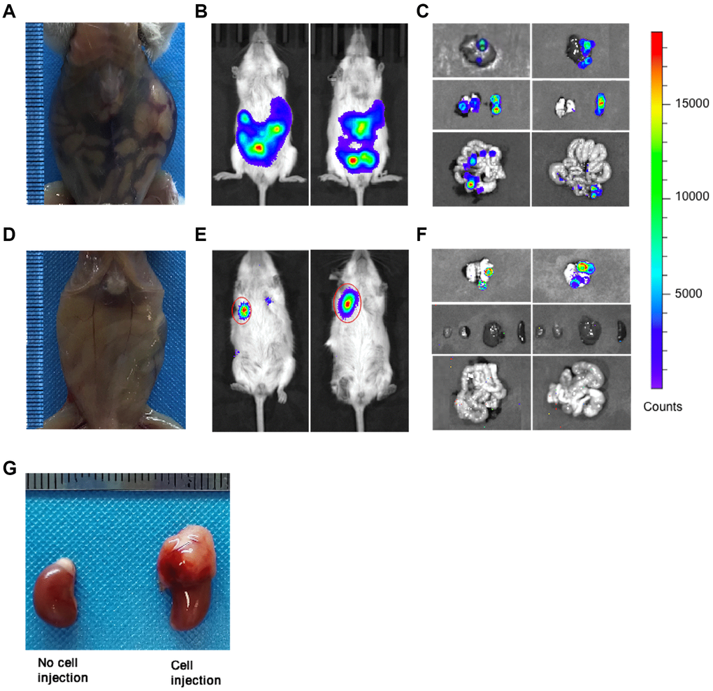 Tumor metastasis in orthotopic and subcutaneous CDX mice. (A) Representative image of orthotopic CDX mice was taken at day 14 after cell implantation (Mice used, n = 6, Representative data used, n = 1). (B) Representative bioluminescence images of tumors in orthotopic CDX mice (Mice used, n = 6, Representative data used, n = 2). (C) Representative bioluminescence images for the metastatic liver, lung, spleen and intestine in orthotopic CDX mice (Mice used, n = 6, Representative data used, n = 2). (D) Representative image of subcutaneous CDX mice were taken at day 21 after cell implantation (Mice used, n = 5, Representative data used, n = 1). (E) Representative bioluminescence images of tumors in subcutaneous CDX mice (Mice used, n = 5, Representative data used, n = 2). (F) Representative bioluminescence images for the metastatic liver, lung, spleen and intestine in subcutaneous CDX mice (Mice used, n = 5, Representative data used, n = 2). (G) Representative images for the kidneys and the adrenal glands were injected with or without cells (two kidneys from one CDX mouse). Left: Kidney without cell injection. Right: Kidney with cell injection.
