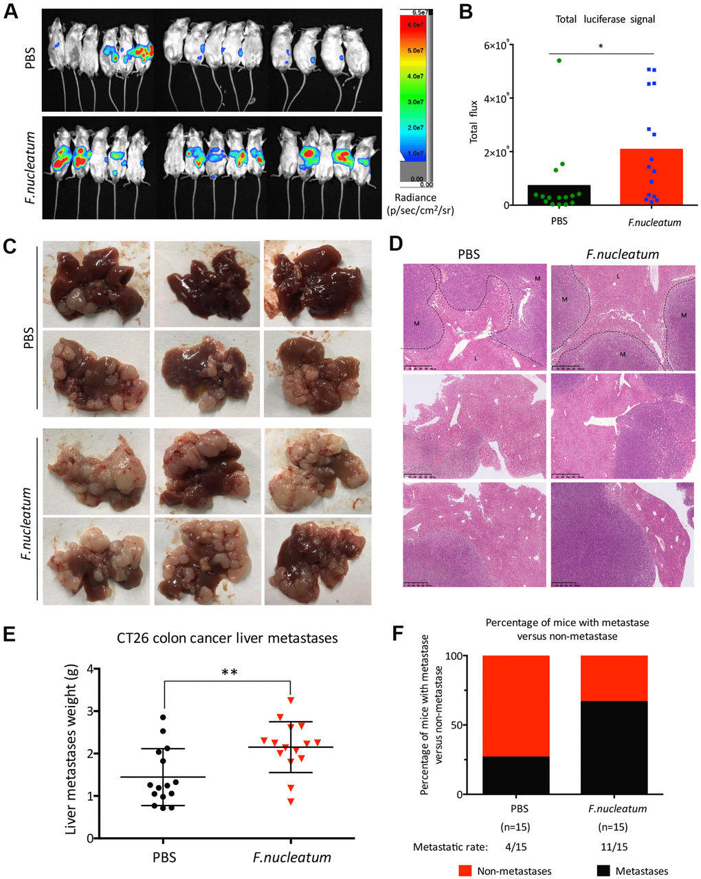 Administration of Fusobacterium nucleatum promotes liver metastasis of colorectal cancer in mice. (A, B) PBS-resuspended 109 colony-forming units of F. nucleatum or PBS were administrated to mice for 8 weeks by gavage every day. The mice received intra-splenic injection post 2-week administration of F. nucleatum or PBS intragastrically. At day 28 after intra-splenic transplantation of CT26-Luc cells, in vivo bioluminescence imaging was used to assess liver metastases (A) of BALB/c mice (n=15 per group). (B) The corresponding data expressed by the change in the total signal flux. Data are presented as mean ± standard deviation (SD; *P P P C, D) After the 2-week treatment of F. nucleatum or PBS, mice received intra-splenic injection of CT26 tumor cells. Four weeks later, the mice were euthanized, and subsequent histological studies were performed. The representative metastatic foci (C) and hematoxylin and eosin-stained liver sections (D) in mice are shown. (E, F) Livers were weighed (E) and liver metastatic rates were measured (F). Data are presented as mean ± SD (*P P P 