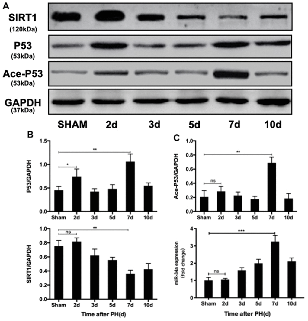 P53/miR-34a/SIRT1 positive feedback loop expression during LR. (A) Protein expression of the P53/miR-34a/SIRT1 positive feedback loop during LR progression was analyzed via western blot. (B) Quantification of hepatic P53, Ace-P53, and SIRT1 expression at the indicated time points after PH by WB. (C) Quantification of hepatic miR-34a expression at the indicated time points after PH by qPCR. (ns: not significant, p>0.05; *, p