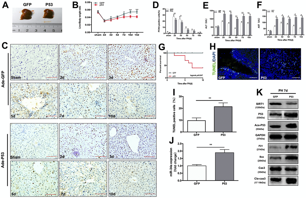 Overexpression of wild-type P53 terminates LR and activates the P53/miR-34a/SIRT1 positive feedback loop early during LR. (A) Representative livers from mice at 7 days after PH between Ade-GFP and Ade-P53 mice. (B) Liver weight relative to body weight at the indicated time points after PH. (C) Representative images of PCNA staining at the indicated time points after PH from the Ade-GFP and Ade-P53 groups (magnification: ×200, scale bars represent 50 μm). (D) Quantification of PCNA-positive cells in the liver at the indicated time points after PH. (E, F) Serum AST and ALT levels in Ade-GFP and Ade-P53 mice after PH. (G) Survival rate of mice that underwent PH from the Ade-GFP and Ade-P53 groups(p=0.047, logrank test). (H) Representative images of TUNEL staining at day 7 after PH in liver tissue (magnification: ×400). (I) Quantification of TUNEL-positive cells in the liver at day 7 after PH. (J) Quantification of hepatic miR-34a expression between Ade-GFP and Ade-P53 mice at day 7 after PH by qPCR. (K) Protein expression of P53/miR-34a/SIRT1 positive feedback loop genes between Ade-GFP and Ade-P53 mice day 7 after PH. (*, p