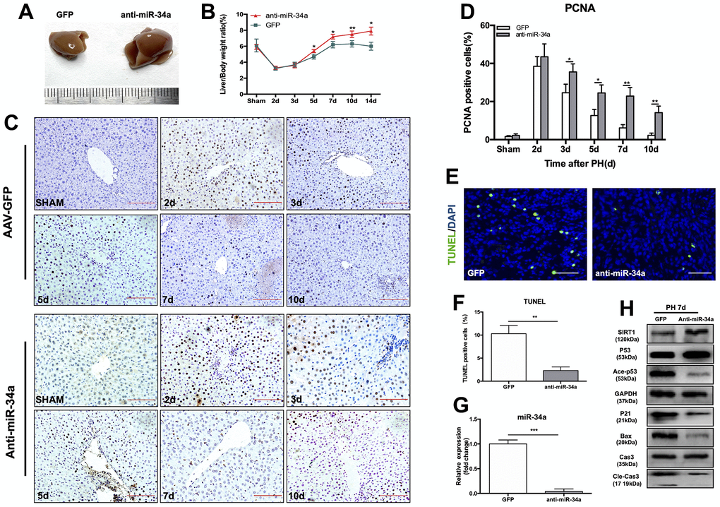 Knock-down of miR-34a suppresses the P53/miR-34a/SIRT1 positive feedback loop early during LR. (A) Representative livers from mice at 7 days after PH between AAV-GFP and AAV-anti-miR-34a mice. (B) Liver weight relative to body weight at the indicated time points after PH. (C) Representative images of PCNA staining at the indicated time points after PH in the GFP and anti-miR-34a groups (magnification: ×200, scale bars represent 50 μm). (D) Quantification of PCNA-positive cells in the liver at the indicated time points after PH. (E) Representative images of TUNEL staining at day 7 after PH in liver tissue (magnification: ×400). (F) Quantification of TUNEL-positive cells in the liver at day 7 after PH. (G) Protein expression of P53/miR-34a/SIRT1 positive feedback loop genes between AAV-GFP and AAV-miR-34a mice at day 7 after PH. (H) Quantification of hepatic miR-34a expression between AAV-GFP and AAV-miR-34a mice at day 7 after PH by qPCR. (*, p
