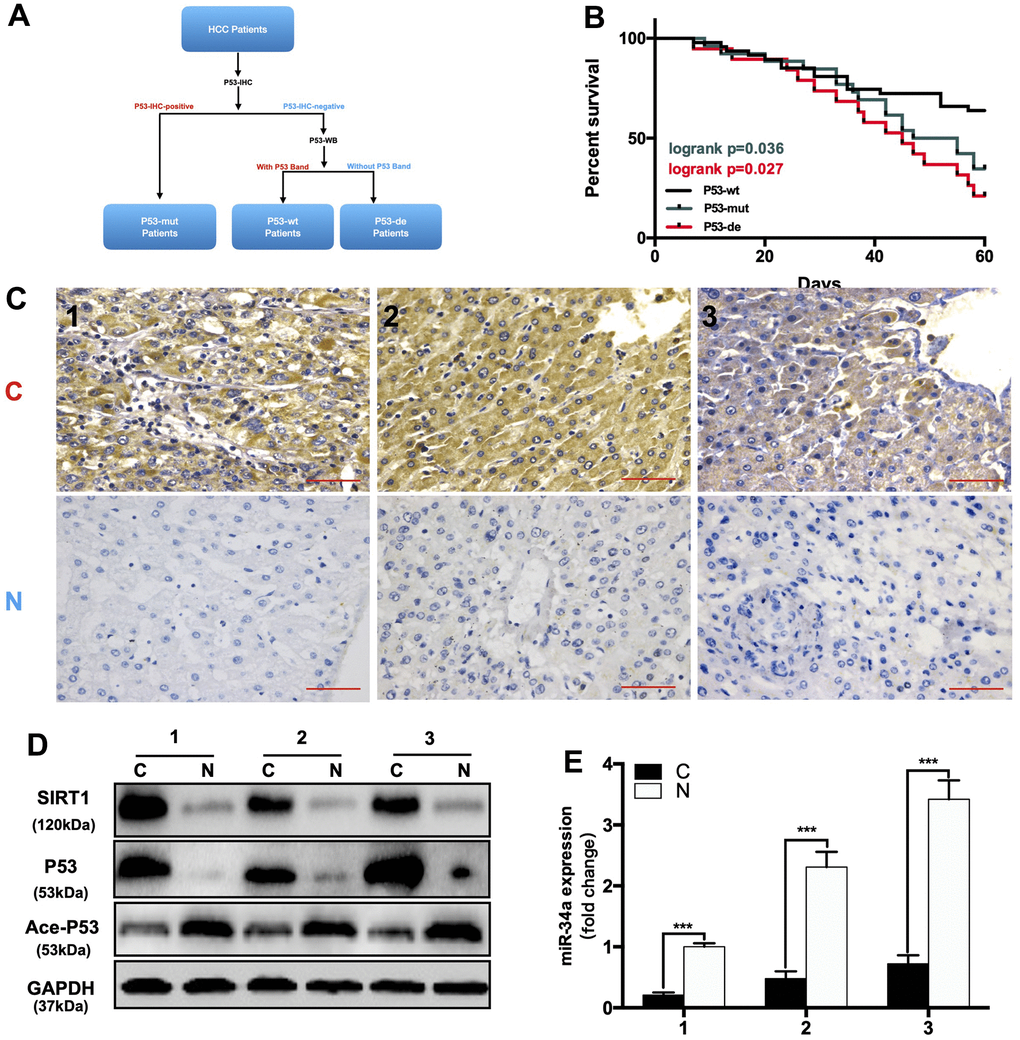 The expression of the P53/miR-34a/SIRT1 positive feedback loop in hepatocellular carcinoma patients. (A) A brief diagram of how 92 HCC patients were divided. (B) The 5-year survival rate of HCC patients from different groups. (p = 0.036, Green: P53-mutated vs P53-wild-type patients. p = 0.027, Red: P53-deficient vs P53-wild-type patients, log-rank test). (C) Representative images of P53 staining in P53-mutated patients. (D) Protein expression of the P53/miR-34a/SIRT1 positive feedback loop in P53-mutated patient tumor tissue. (E) Quantification of hepatic miR-34a expression in P53-mutated patient tumor tissue.